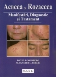 Acneea si Rozaceea. Manifestari, diagnostic si tratament