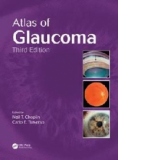 Atlas of Glaucoma