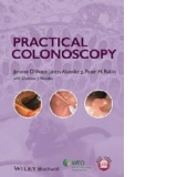 Practical Colonoscopy