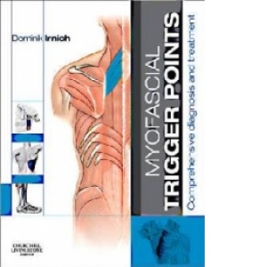 Myofascial Trigger Points