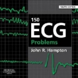 150 ECG Problems