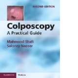 Colposcopy