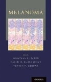 Melanoma