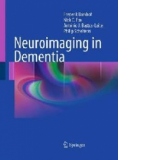 Neuroimaging in Dementia