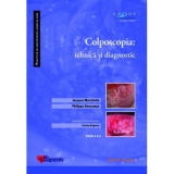 Colposcopia : tehnica si diagnostic