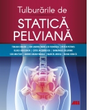 Tulburarile de statica pelviana