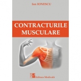 Contracturile musculare