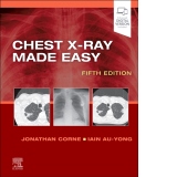 Chest X-Ray Made Easy