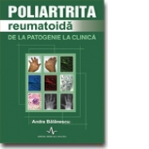 POLIARTRITA REUMATOIDA - de la patogenie la clinica